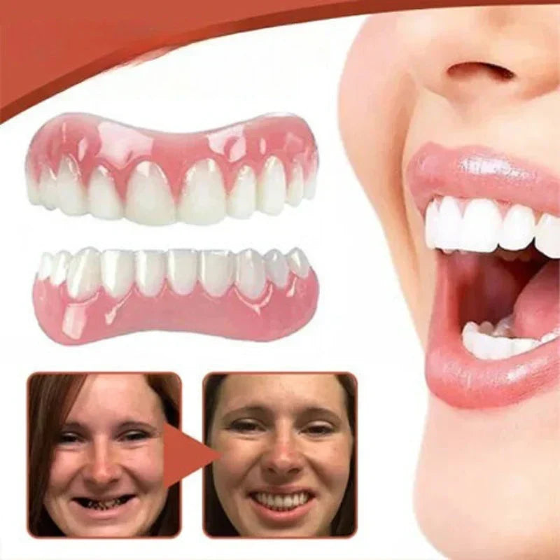 Snap On Veneers Custom Moldable Fit - Image 4
